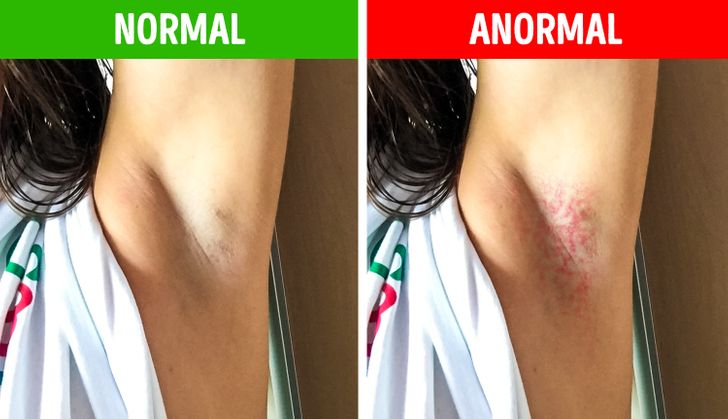 erros comuns ao tratar alergia nas axilas