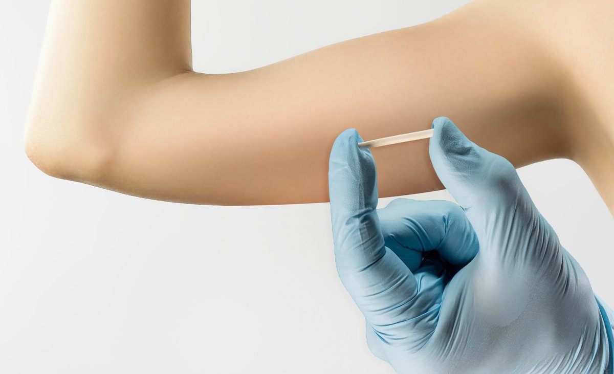 melhores métodos contraceptivos de longa duração