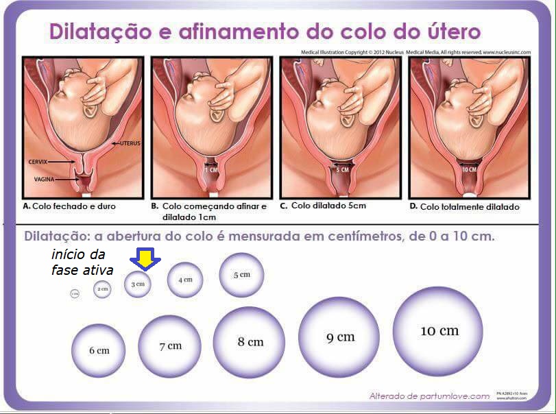 com quantas semanas posso começar a fazer exercícios para dilatar